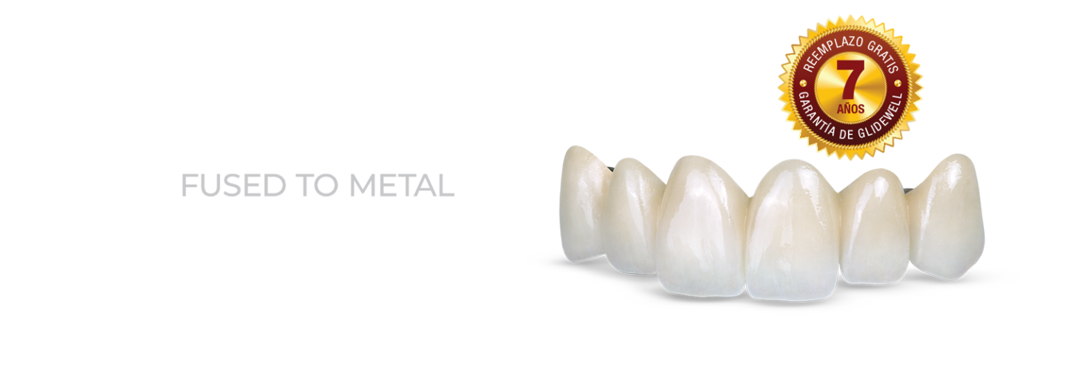 Glidewell México Dental Lab Productos y Servicios