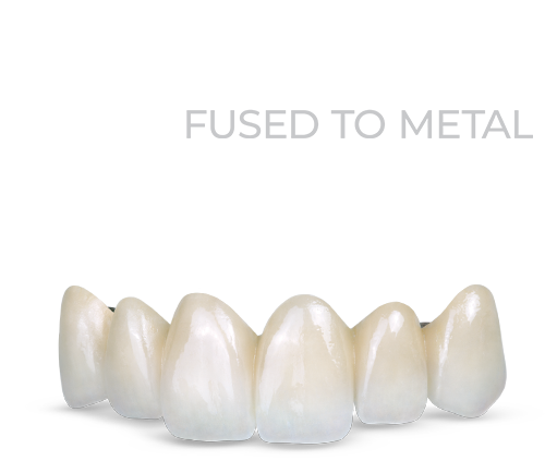 Metal - Glidewell Dental México