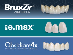 BruxZir Zirconia, IPS e.max, Obsidian 4x